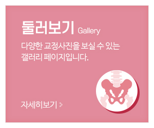 (주)몸의중심_메인중간_교정사진